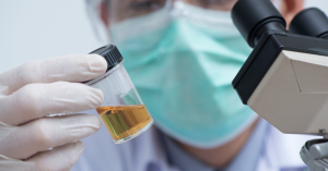 Exames Toxicológicos